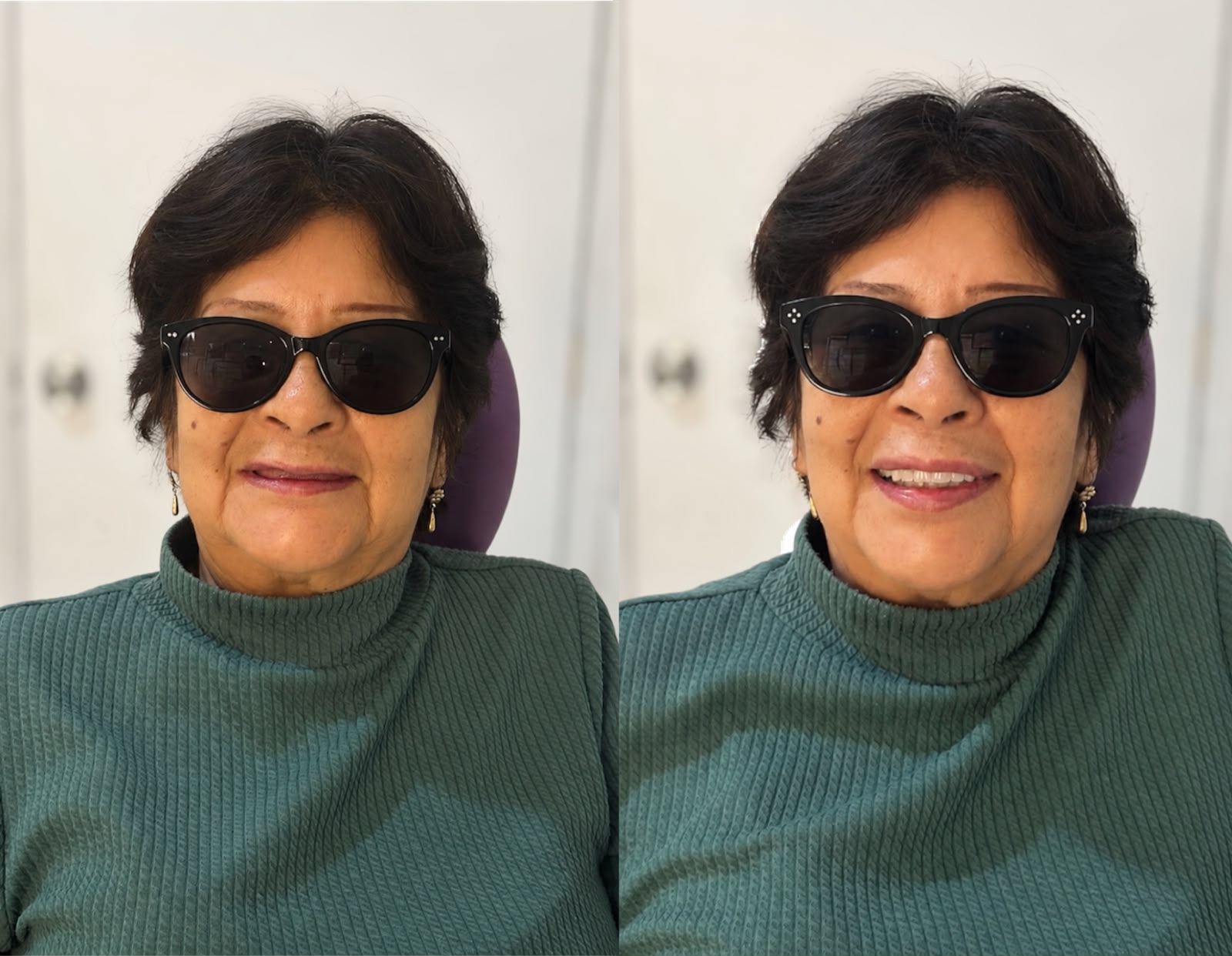 Cambio estético dental antes y después en Dental Wox, Guadalajara